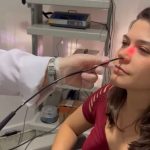 Videoendoscopia nasal